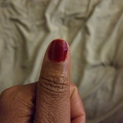 Houra after gel manicure thumb messed up.