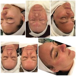Studio 841 - Facials By Brittany here at studio 841 I offer The Hydrafacial, Chemical Peels, Microdermabrasion, Facial massaged, waxing and more.