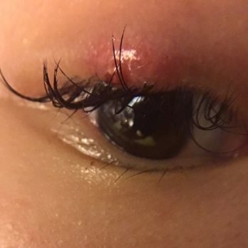 Unique Beauty Salon - Inflammation - Eyelash Service Near Me - Astoria, New York Unique Beauty Salon - Inflammation - Eyelash Service Near Me - Astoria, New York