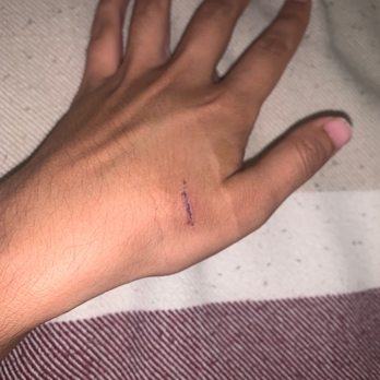 Banner Urgent Care - After having cut glued:) - Urgent Care Near Me - Goodyear, Arizona Banner Urgent Care - After having cut glued:) - Urgent Care Near Me - Goodyear, Arizona
