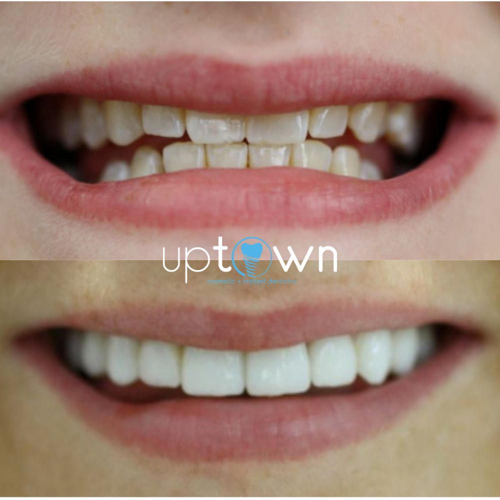 UPTOWN COSMETIC & IMPLANT DENTISTRY 110 Photos & 18 Reviews 2425 W