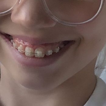 Royal Dental Spa - Happy child:) - General Dentistry Near Me - Studio City, California
