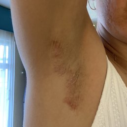This is my armpit This is my armpit