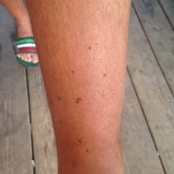 Birds Nest Lodge - Fleas from being in the cabin for 10 seconds.