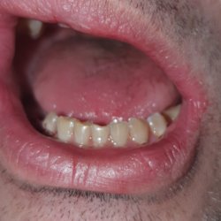 Greenhill Periodontics & Implants