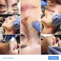Seattle Sugar Bar - Another great face polish sugaring. Call it the deep facial because it removes oil and dirt from under your skin.