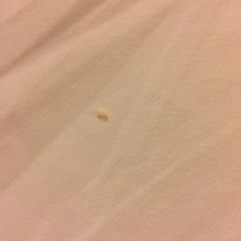 Courtyard by Marriott Vallejo Napa Valley - The Roach and the eggs it was laying on my arm!!! Uncovered wall plug where it probably came from!!!! - Hotels Near Me - Vallejo, California Courtyard by Marriott Vallejo Napa Valley - The Roach and the eggs it was laying on my arm!!! Uncovered wall plug where it probably came from!!!! - Hotels Near Me - Vallejo, California