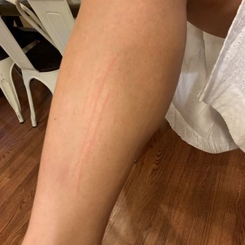 Q Nails & spa - Scratches from pedicure - Nail Salons Near Me - Colorado Springs, Colorado Q Nails & spa - Scratches from pedicure - Nail Salons Near Me - Colorado Springs, Colorado