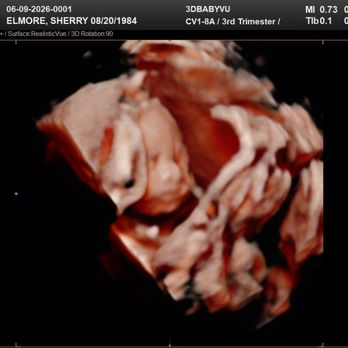 3DBabyVu - Ultrasound Imaging Centers Near Me - Pleasanton, California 3DBabyVu - Ultrasound Imaging Centers Near Me - Pleasanton, California