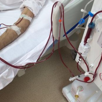 Ontario Dialysis Center - Dialysis Clinics Near Me - Ontario, California Ontario Dialysis Center - Dialysis Clinics Near Me - Ontario, California