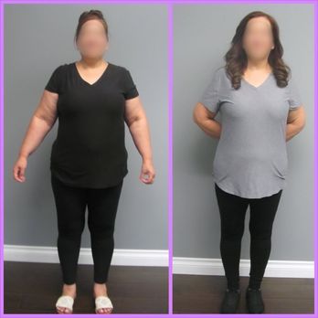 Slimmer Solutions - This rockstar lost 40 lbs on her hCG plus Clean Eating combo! She was so dedicated and consistent, which are 2 key ingredients for success! - Weight Loss Centers Near Me - La Verne, California Slimmer Solutions - This rockstar lost 40 lbs on her hCG plus Clean Eating combo! She was so dedicated and consistent, which are 2 key ingredients for success! - Weight Loss Centers Near Me - La Verne, California