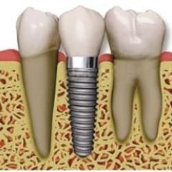 Wellington Dental Associates