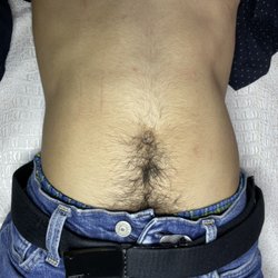 Angel Beauty - Stomach waxing (before)