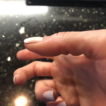 Sugar Nails & Lashes - Swollen and red - Nail Salons Near Me - Orange, California