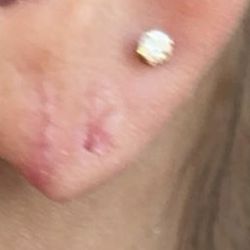 Chicagoland Aesthetics Plastic Surgery And Medi Spa - This is an inexperienced doctors work