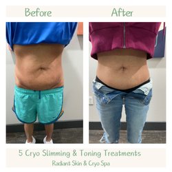 Radiant Skin & Cryo Spa LLC