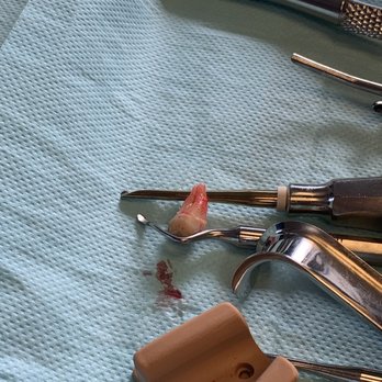 Central Park Oral Surgery - Oral Surgeons Near Me - New York, New York Central Park Oral Surgery - Oral Surgeons Near Me - New York, New York