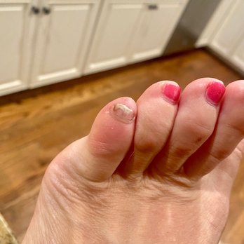 Bella Nail Spa - Today. Think it's fungus. The more I clip the toenail back, the whiter it gets. How dare Bella Nails do this to my foot. - Nail Salons Near Me - San Ramon, California Bella Nail Spa - Today. Think it's fungus. The more I clip the toenail back, the whiter it gets. How dare Bella Nails do this to my foot. - Nail Salons Near Me - San Ramon, California