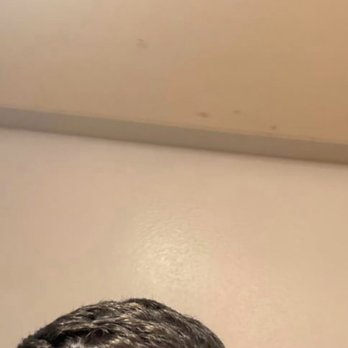 Neopel - Hair Loss Centers Near Me - Tijuana, BCN