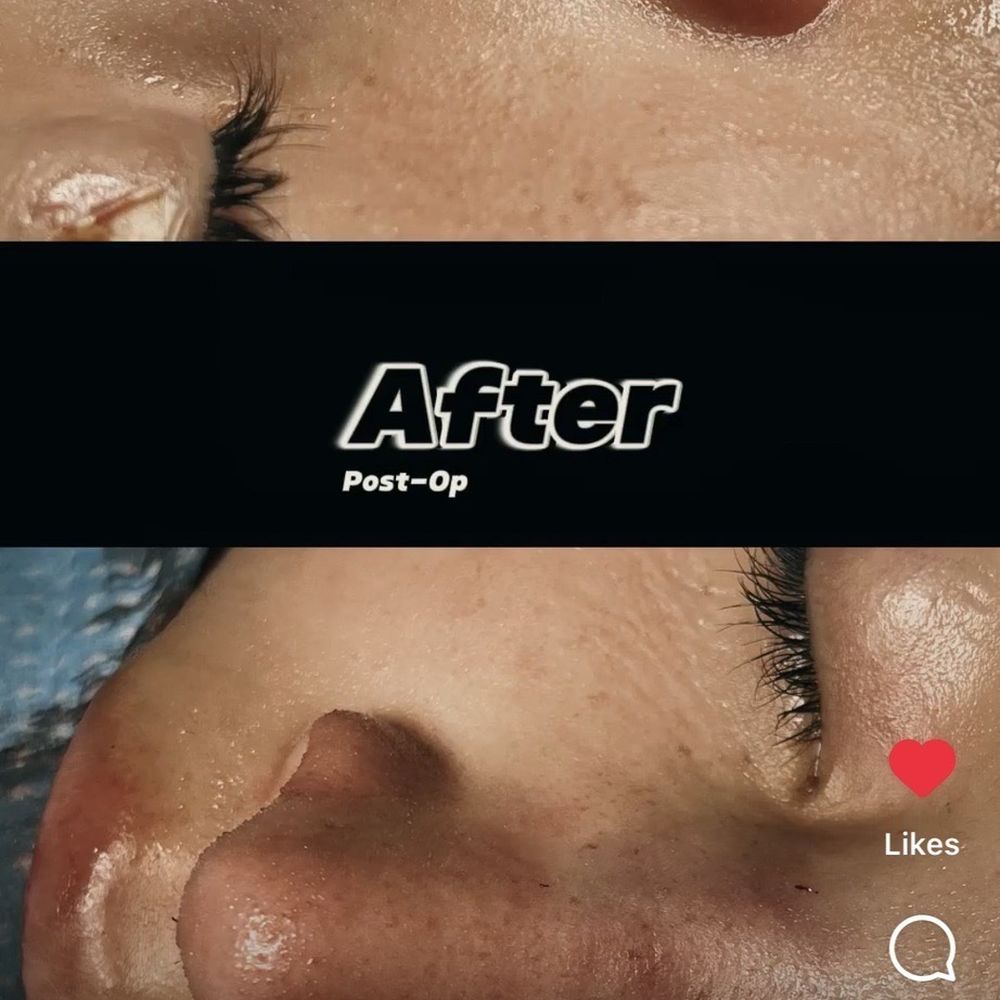Jose Barrera, MD - after photos - Cosmetic Surgeons Near Me - San Antonio, Texas