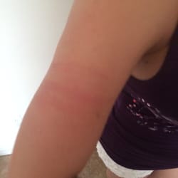 Princess Nails - Holy store manager of Princess Nails assaulted me on my arm