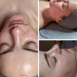 Face Envy Aesthetics - Dermaplane facial