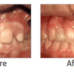 Arctic Smiles Orthodontics