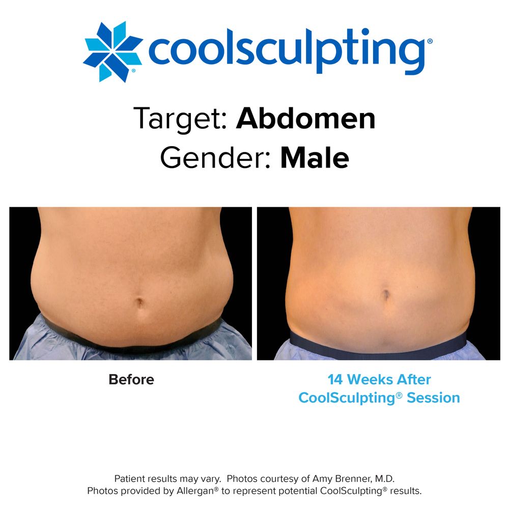 Hyper Sculpt Body Contouring Logo