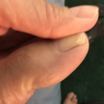 Sky Nails Spa - Ripped nail - Nail Salons Near Me - El Paso de Robles, California Sky Nails Spa - Ripped nail - Nail Salons Near Me - El Paso de Robles, California