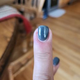 Infection, pain, pus, terrible work
