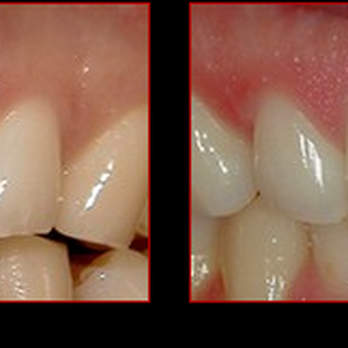 Edison Dental Arts - Cosmetic Dentists Near Me - Edison, New Jersey