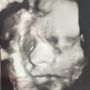 Photo of Ultrasona Fetal Fotos
