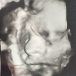 Ultrasona Fetal Fotos - Ultrasound of my little guy