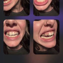 Tarzana Smile Center - Before !!!!