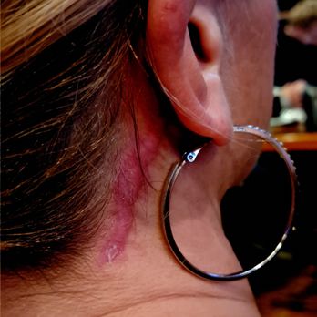 Ronald M. Warren, MD FACS - Cosmetic Surgeons Near Me - Marlton, New Jersey Ronald M. Warren, MD FACS - Cosmetic Surgeons Near Me - Marlton, New Jersey