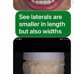 I asked not a natural front dominant teeth. They provided horse teeth I asked not a natural front dominant teeth. They provided horse teeth