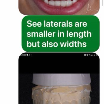 Joseph Goodman, DDS, DMD - I asked not a natural front dominant teeth. They provided horse teeth - General Dentistry Near Me - Beverly Hills, California Joseph Goodman, DDS, DMD - I asked not a natural front dominant teeth. They provided horse teeth - General Dentistry Near Me - Beverly Hills, California