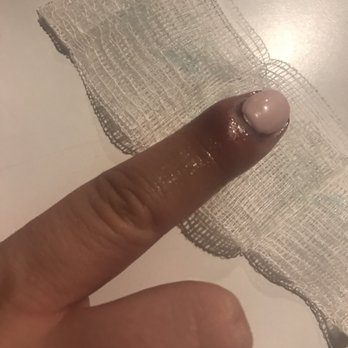 New York Nails - Infection from a cut in a manicure, its worse than it looks . - Nail Salons Near Me - South Gate, California New York Nails - Infection from a cut in a manicure, its worse than it looks . - Nail Salons Near Me - South Gate, California