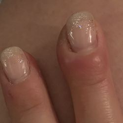 Chic Nails & Spa - Infected middle fingernail