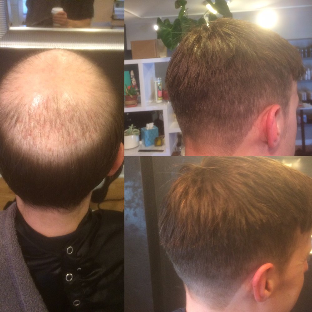 Men S Hair Replacement At Salon Juan Yelp