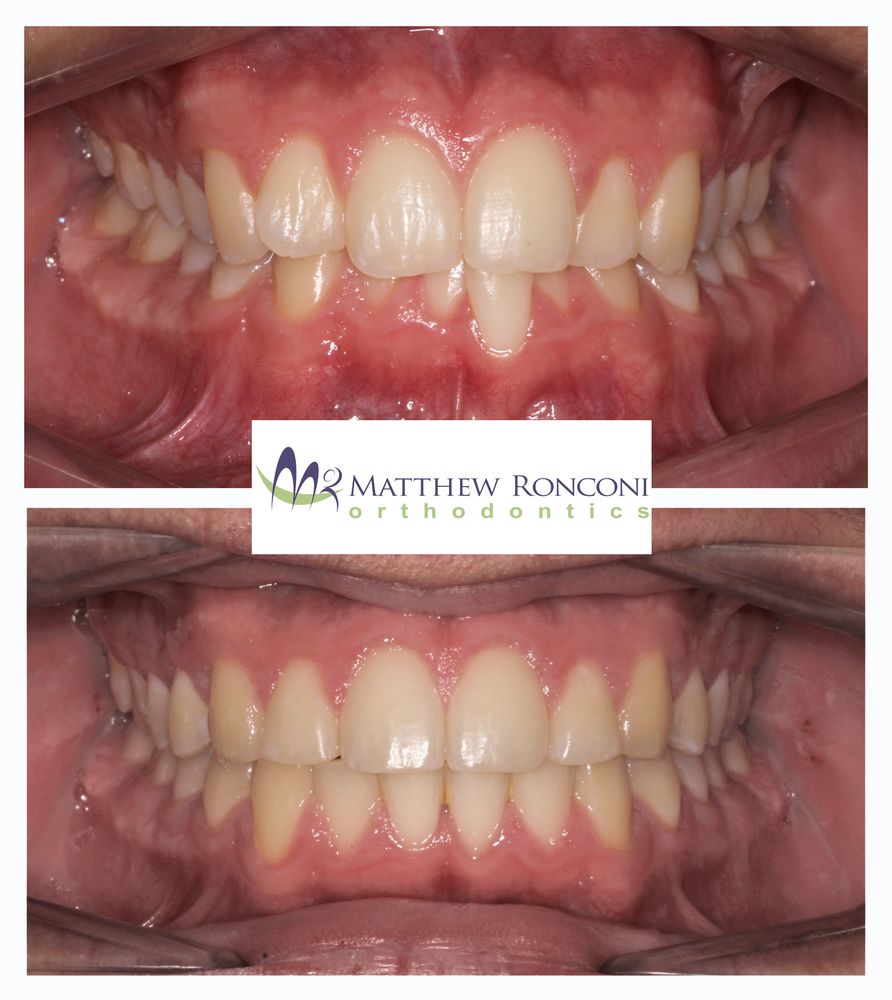 Matthew Ronconi Orthodontics Logo