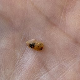 Hard object found in food.