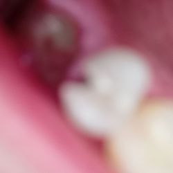 Arbor Dental
