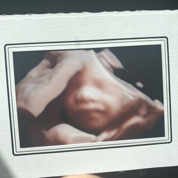 Take A Peek Boutique - Baby girl's little smirk - Ultrasound Imaging Centers Near Me - Gilroy, California Take A Peek Boutique - Baby girl's little smirk - Ultrasound Imaging Centers Near Me - Gilroy, California