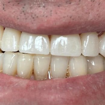 Michael W King, DDS - General Dentistry Near Me - Jackson, Tennessee Michael W King, DDS - General Dentistry Near Me - Jackson, Tennessee