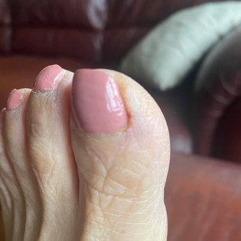 Caesars Nails & Spa - Throbbing pain, infection, redness, hot to the touch, swollen, painful to stand or walk. Also with fever and chills. - Nail Salons Near Me - Houston, Texas Caesars Nails & Spa - Throbbing pain, infection, redness, hot to the touch, swollen, painful to stand or walk. Also with fever and chills. - Nail Salons Near Me - Houston, Texas