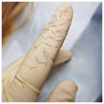 Jennie Bradach Electrolysis - Hair Removal Near Me - McKinney, Texas Jennie Bradach Electrolysis - Hair Removal Near Me - McKinney, Texas