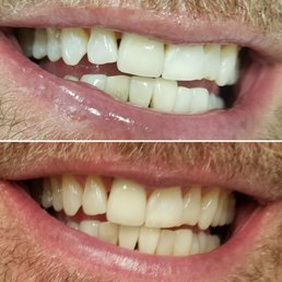Before and after Before and after