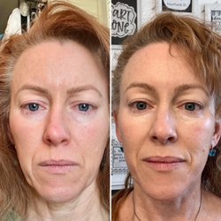 Youthful Skin by Anna - My skin feels firmer, less fine lines & wrinkles, blackheads removed. eyes less puffy, jawline lifted. I'm a forever fan of Anna!