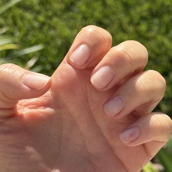 NailTec Spa - Damaged pinky nail from drill - Nail Salons Near Me - Marina del Rey, California NailTec Spa - Damaged pinky nail from drill - Nail Salons Near Me - Marina del Rey, California